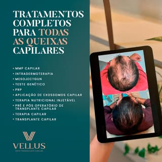 Queda, falhas, afinamento… cada caso tem uma causa.

Por isso, na Vellus, os tratamentos são definid