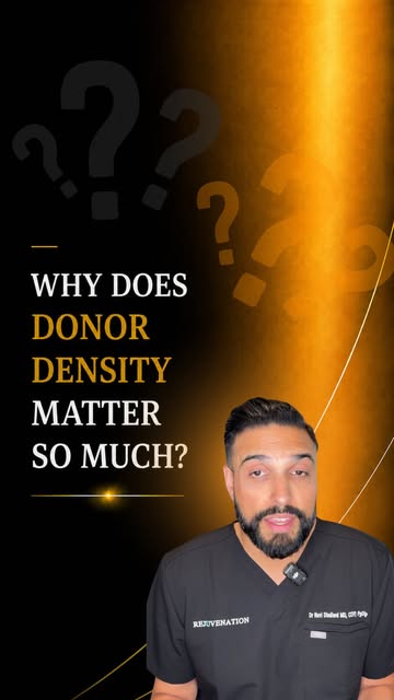 The key thing to understand? Donor hair is a limited resource.

• Strong donor density can provide m