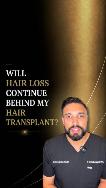 During hair transplant surgery, healthy follicles are taken from a more stable donor area and transp