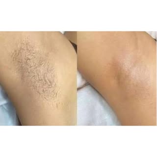 ✨ Smooth Skin, Just in Time for Summer! ✨

Reviva Hair & Skin is excited to offer a limited-time spe