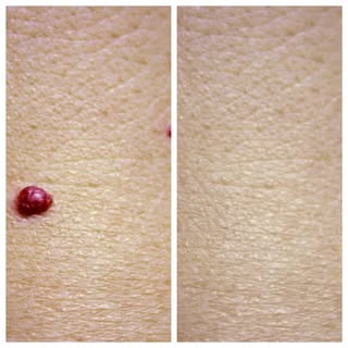✨ CLEARER SKIN STARTS HERE ✨

At Reviva Hair and Skin Clinic, we're excited to introduce targeted tr