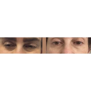 ✨ Super WOW Effect for Your Eyes! ✨

Say goodbye to tired eyes, fine lines, and stubborn pigmentatio