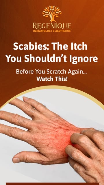 That itch getting worse at night? Don’t ignore it. 👀

Itching that gets worse at night could be sca