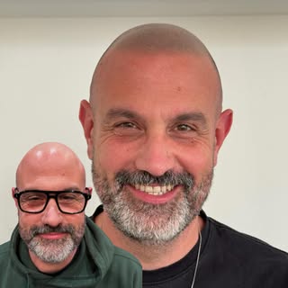 Effet rasé avec ligne frontale naturelle pour Jé 🔥 
Résultat cicatrisé à 4 mois!

#micropigmentatio