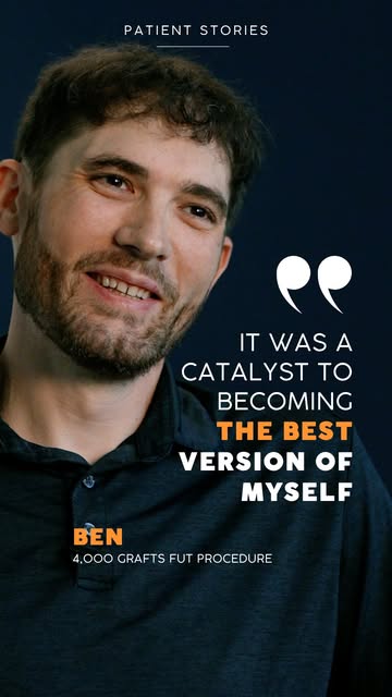 For nearly 10 years, Ben rarely went anywhere without a hat.

His hair loss had taken a toll on his 