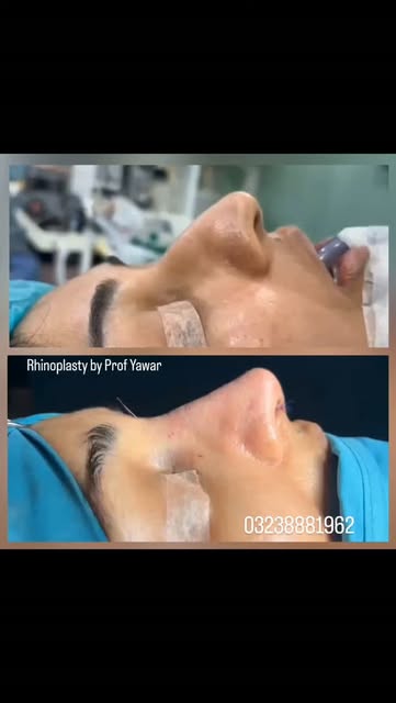 Website: www.dryawarplasticsurgery.com
Facebook: yawarplasticsurgery
Instagram: dryawarsajjad
Phone: