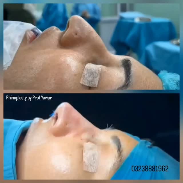 Website: www.dryawarplasticsurgery.com
Facebook: yawarplasticsurgery
Instagram: dryawarsajjad
Phone: