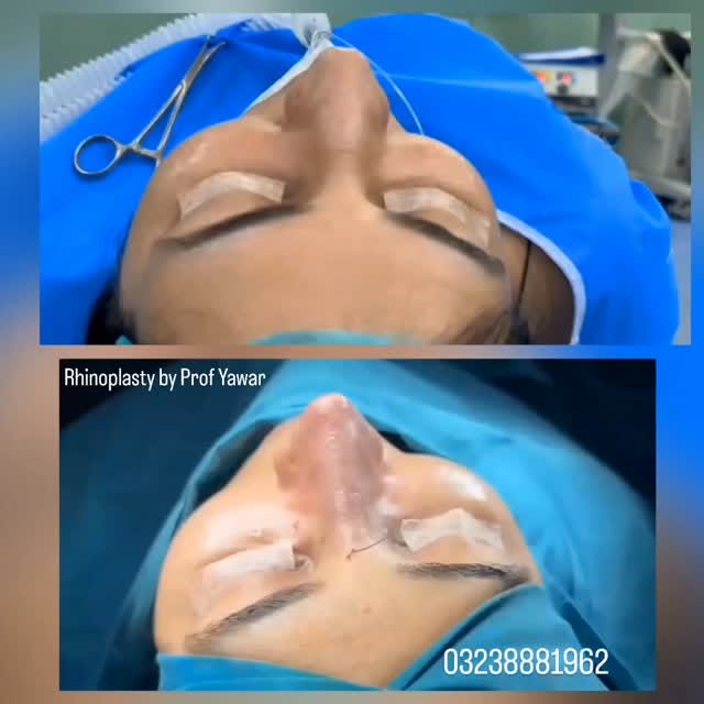 Website: www.dryawarplasticsurgery.com
Facebook: yawarplasticsurgery
Instagram: dryawarsajjad
Phone: