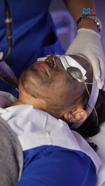 When your skin feels dull, oily or congested, a Carbon Laser Peel can help refresh its appearance by