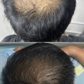 Not all hair problems require surgery 💉
Medication is of utmost importance ✨