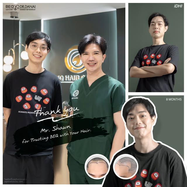 ปัญหาที่เคยกังวล…วันนี้ไม่ใช่ปัญหาแล้วครับ 😊

จากวันแรกที่กังวลเรื่องแนวผม จนวันนี้ผ่านมา 8 เดือน แ