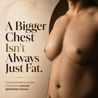 ✨ A BIGGER CHEST ISN’T ALWAYS JUST FAT. 💙

Gynecomastia can be caused by excess glandular tissue, c