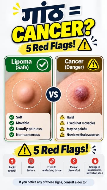 😱 शरीर पर गांठ मिली? घबराएं नहीं… लेकिन Ignore भी न करें!
Lipoma या Cancer? 🤔
हर गांठ Cancer नहीं 