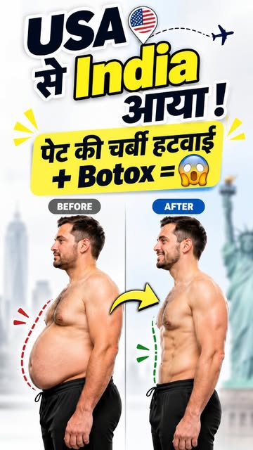 🇺🇸➡️🇮🇳 USA से India सिर्फ Liposuction & Botox के लिए!
43-year-old US Citizen ने करवाए:
✨ Abdomen
