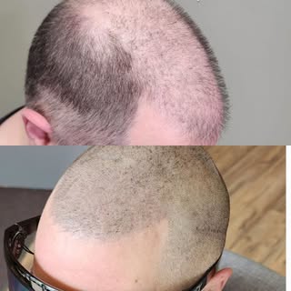 You didn’t choose this change.
But you can choose how it looks.

You  just want to stop noticing the