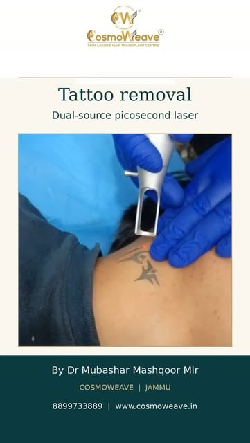 Your story evolves. Your ink can too. ✨

Considering a change? Explore tattoo removal with our dual-