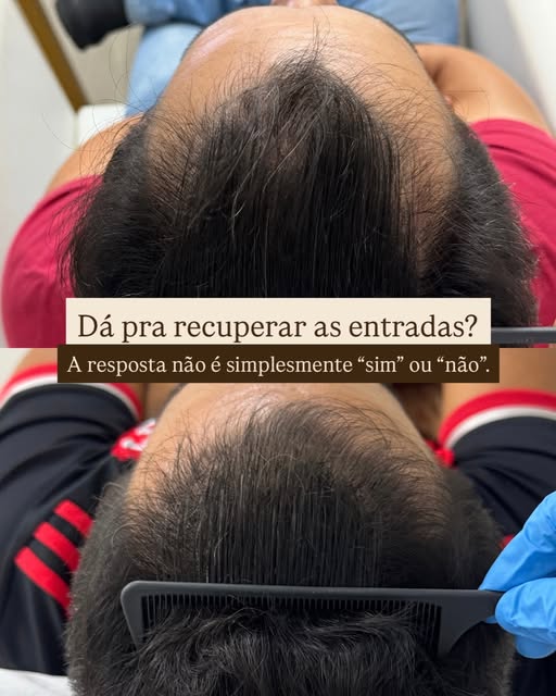 Nem toda entrada vai preencher completamente. Mas também não é verdade que entrada nunca responde ao