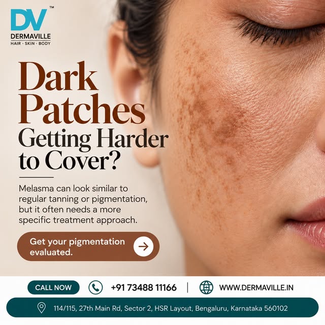 Dark patches and uneven pigmentation can be difficult to manage when the underlying cause isn’t iden