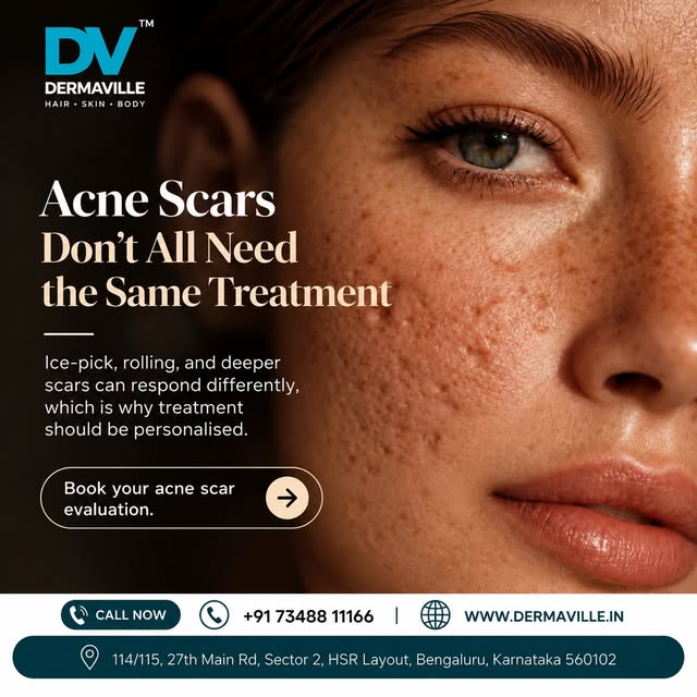 Acne scars are not all the same — and neither should be the approach to treating them. ✨

Ice-pick, 