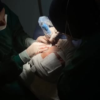 Endlich zufrieden 😎🙌🏼

#hairtransplant #hair #biohair #haare #haartransplantation