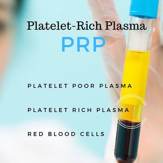 PRP? Liquid Gold? Vampire facial?! Do tell! The vampire facial, also known as the platelet-rich plas