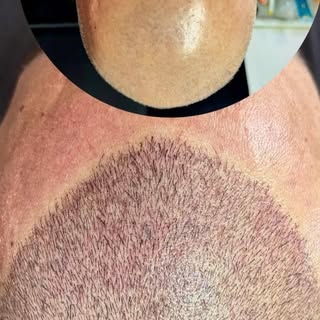 Pigmentação Capilar Fio a Fio 4T com Efeito EXCLUSIVO de Penteado!
Sensacional, não é?

VENHA!

📲31