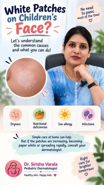 Here is a quick guide for one most common skin issue in children - White patches on face !! 

The go