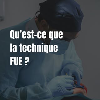 Vous envisagez une greffe capillaire? La FUE est une technique moderne pour retrouver une chevelure 