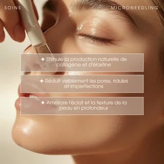 Offrez un nouveau souffle à votre peau grâce au microneedling.

⭐ Stimule la production de collagène