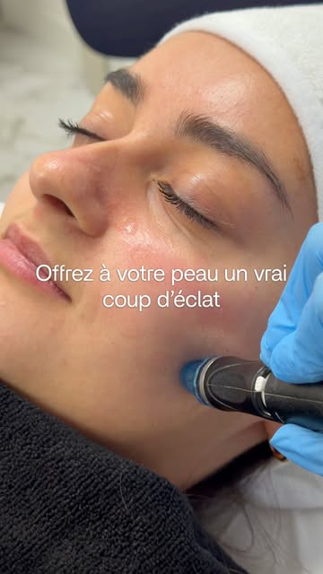 L'hydrafacial - Votre soin pour la rentrée !
Offrez à votre peau un vrai coup d'éclat avec notre soi