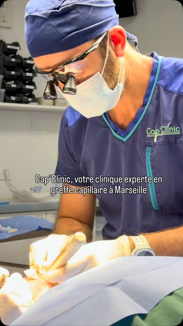 💆‍♂️ Cap’Clinic, votre centre expert en greffe capillaire à Marseille.

Chaque intervention est réa