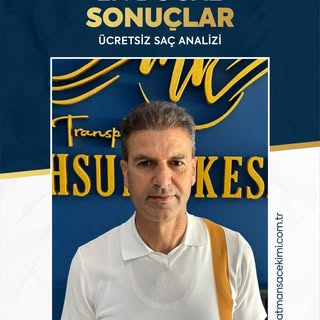 ✨ En Doğal Sonuçlar ✨

Saç ekiminde en büyük başarı, sonucun dışarıdan bakıldığında tamamen doğal du