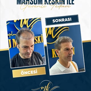 ✨ Öncesi – Sonrası ✨

Doğru planlama ve titiz bir ekim süreciyle değişimi başlatıyoruz.

Aynaya her 