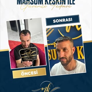 ✨ Öncesi – Sonrası ✨

Doğru planlama ve titiz bir ekim süreciyle değişimi başlatıyoruz.

Aynaya her 