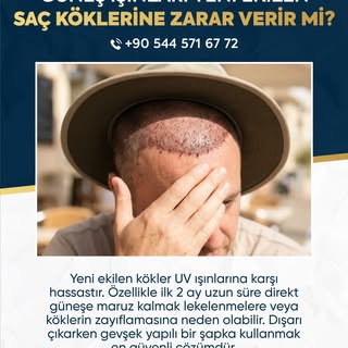 ✨ Güneş Işınları Yeni Ekilen Saç Köklerine Zarar Verir mi? ✨

Yeni ekilen saç kökleri UV ışınlarına 
