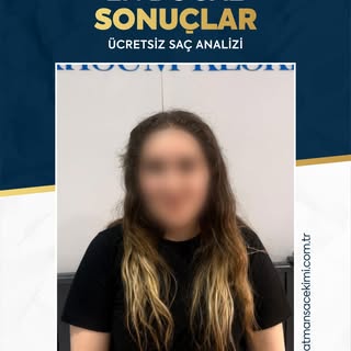 ✨ En Doğal Sonuçlar & Ücretsiz Saç Analizi ✨

Saç ekiminde başarının anahtarı, dışarıdan bakıldığınd