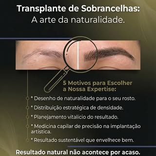 Sobrancelhas que fazem a diferença! ✨ Se você busca um olhar mais expressivo e natural, o transplant