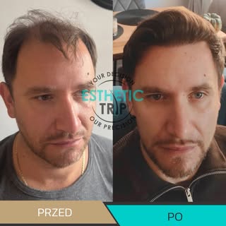 Elvis żyje! 🎙️✨🫶🏻

#przedipo #elvispresley #pacjent #efekty