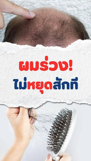 ผมร่วงไม่หยุดสักที...ระวังจะผมบางตามมา❗️

อย่าปล่อยให้ตัวเองมีปัญหาหนังศีรษะ เช่น หนังศีรษะมัน ระคาย