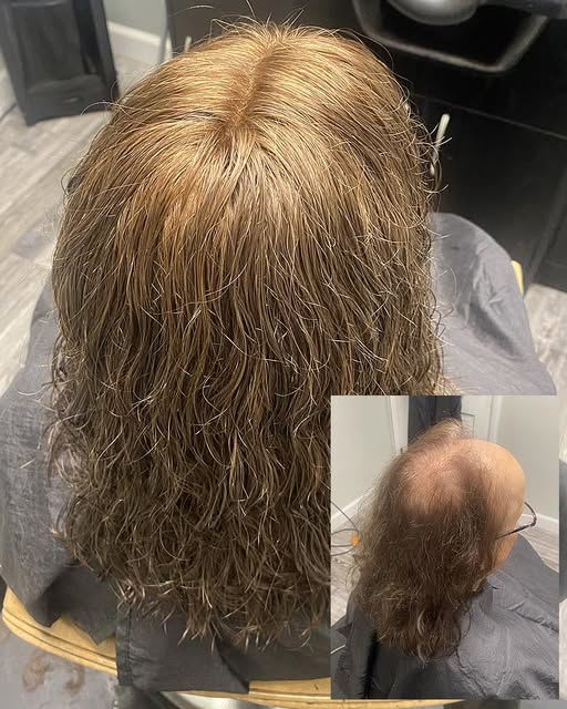 Thinning hair for women can be devastating for many. We work with women all the time looking for sol