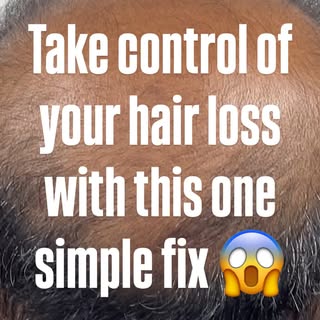 My name’s Will... I’m a Clinical Trichologist & Scalp Micropigmentation Specialist helping men and w