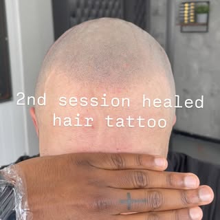 2nd session healed scalp micropigmentation….. 

Fair skin - dark hair = challenging treatment (at ti