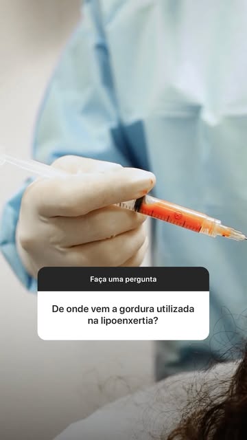 Muita gente não sabe, mas a gordura usada no tratamento capilar vem do próprio paciente, e isso faz 