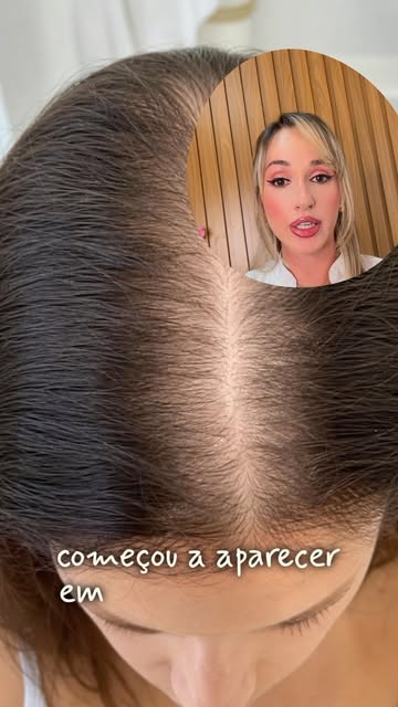 Seu cabelo está tentando te dar sinais. Você está percebendo?

Couro cabeludo aparecendo, rabo de ca