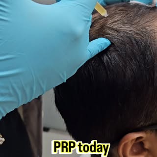 Stronger roots… Healthier hair #hairprp #prp #hair #aesthetic