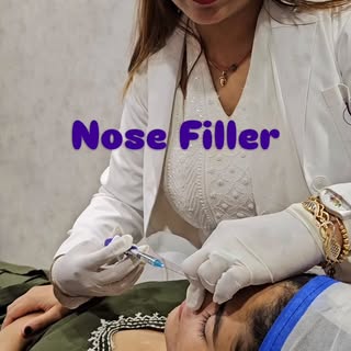 Subtle… Sharp… Natural… #nosefiller #filler #nosejob #liquidrhinoplasty