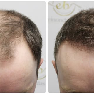 At Dr Bonaros' clinic, this patient's results were carefully planned and conservative, restoring the