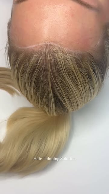 Want a fuller hair line? I have the solution to hair thinning ✨

Say good bye to hair fibers and hel