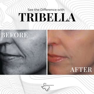 ✨ Three treatments, one incredible transformation! ✨

Check out these stunning before-and-after resu