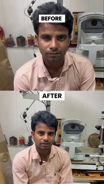 एक हादसे में मरीज की एक आँख चली गई थी और समय पर treatment नहीं हो पाया। लेकिन अब ज़िंदगी में एक नई श
